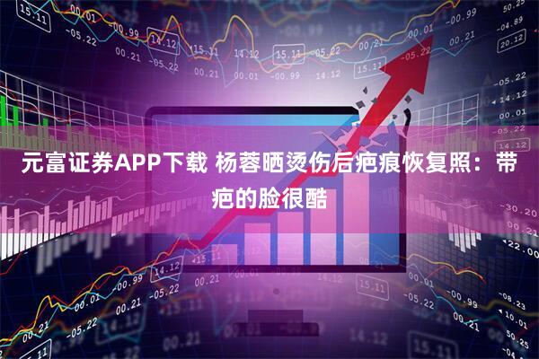 元富证券APP下载 杨蓉晒烫伤后疤痕恢复照：带疤的脸很酷
